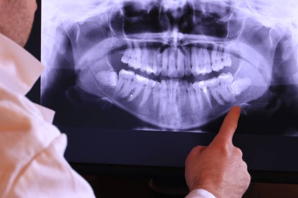 Best Broken or Cracked Tooth Emergency Dentist in Coon Rapids, IA